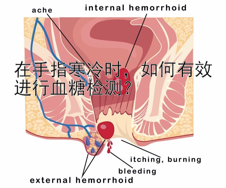 在手指寒冷时，如何有效进行血糖检测？