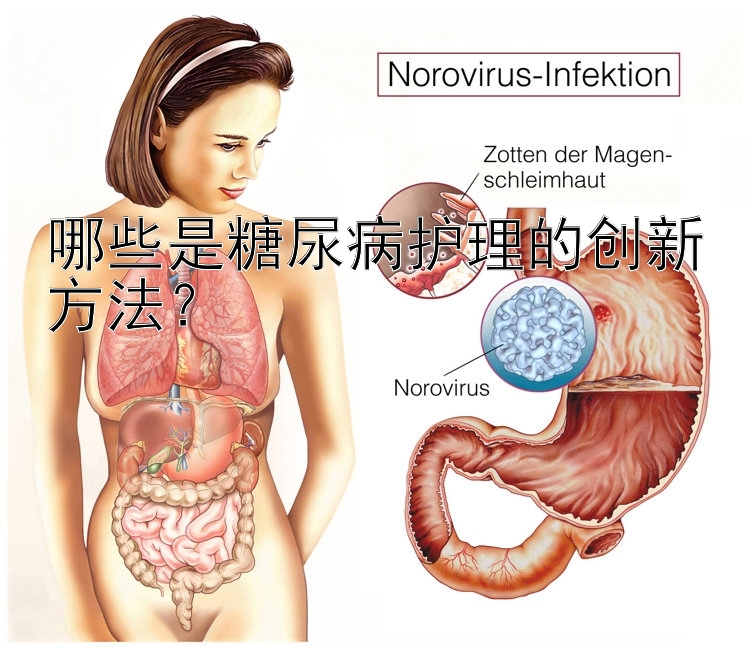 哪些是糖尿病护理的创新方法？