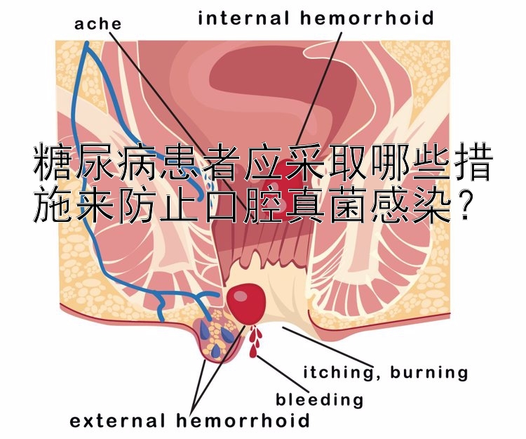 糖尿病患者应采取哪些措施来防止口腔真菌感染？