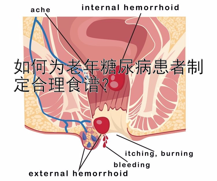 如何为老年糖尿病患者制定合理食谱？