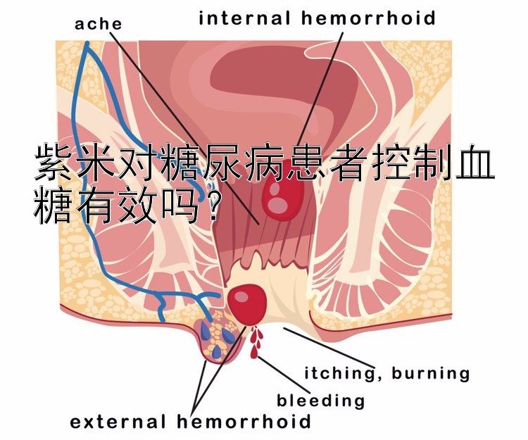 紫米对糖尿病患者控制血糖有效吗？