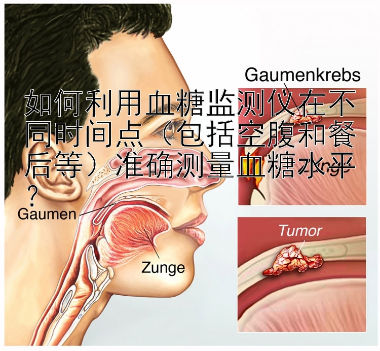 如何利用血糖监测仪在不同时间点（包括空腹和餐后等）准确测量血糖水平？