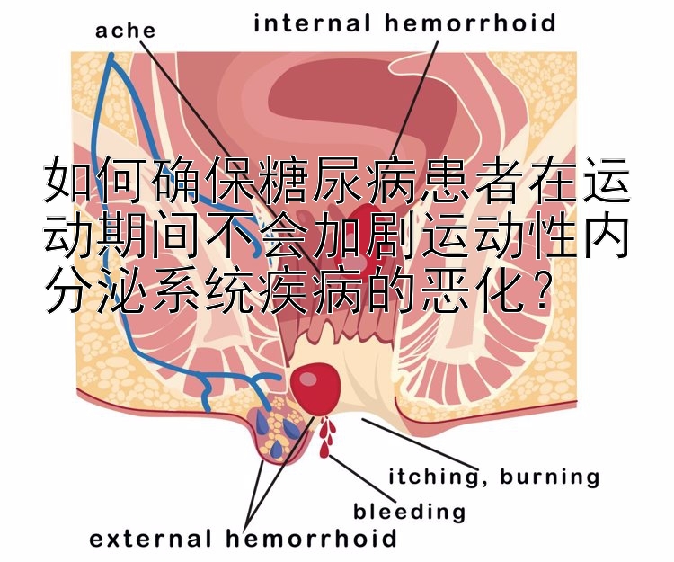 如何确保糖尿病患者在运动期间不会加剧运动性内分泌系统疾病的恶化？