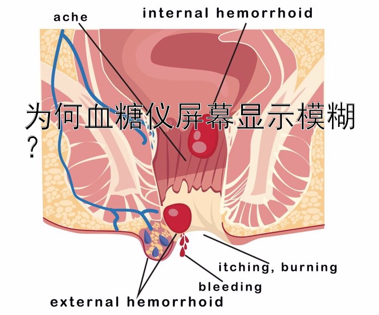 为何血糖仪屏幕显示模糊？