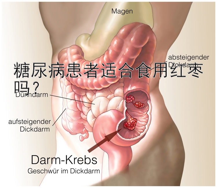 糖尿病患者适合食用红枣吗？