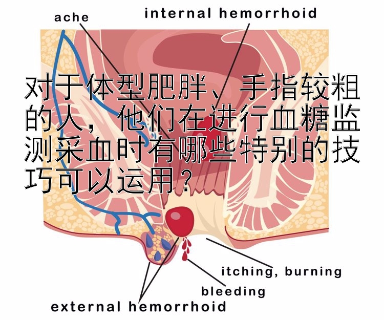 对于体型肥胖、手指较粗的人，他们在进行血糖监测采血时有哪些特别的技巧可以运用？